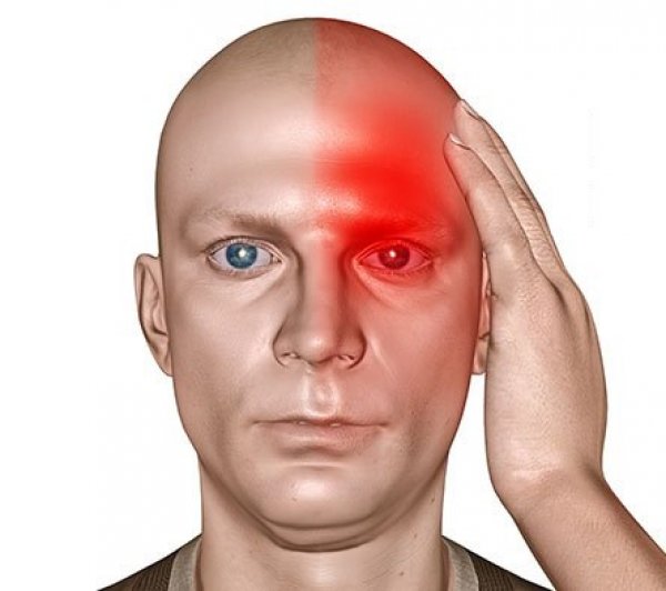 glavobolje-i-migrene-5