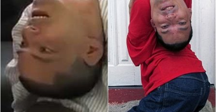 Glava mu je naopako: On je rođen sa teškim hendikepom, ali je postigao više od mnogih (VIDEO)