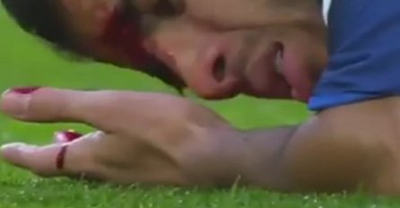  Glava otvorena: Horor povreda Rafinje (FOTO+VIDEO)