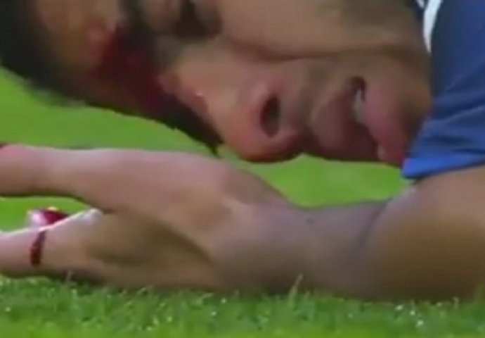  Glava otvorena: Horor povreda Rafinje (FOTO+VIDEO)