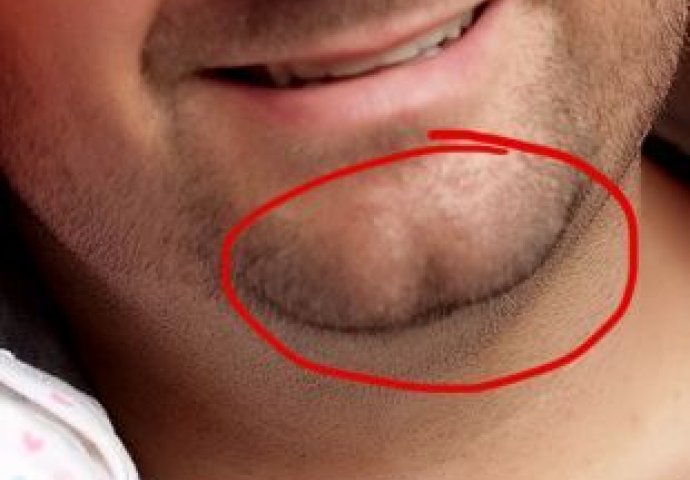 Ako imate rupicu na bradi, to znači da spadate u posebnih 6% svjetske populacije: Iznenadit će vas šta to govori o vama i vašoj skrivenoj ličnosti 