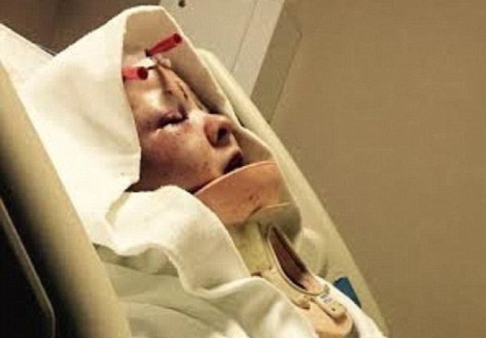 Zlostavljao je svoju djevojku, a onda pustio pit bulla na nju, ali ono što je sljedeće uradio je JEZIVO!