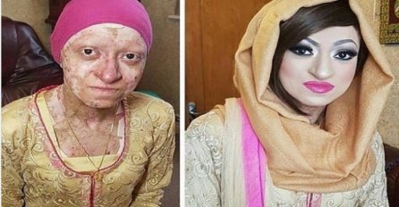  Vjerovali ili ne, na ovoj fotografiji je ista žena: U njenom slučaju šminka ima važnu primjenu