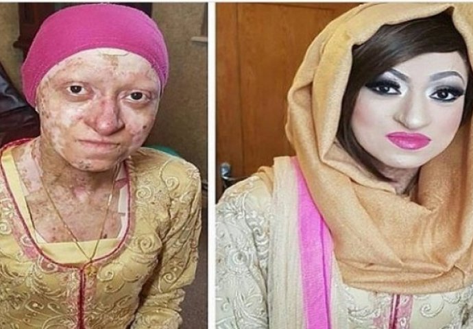  Vjerovali ili ne, na ovoj fotografiji je ista žena: U njenom slučaju šminka ima važnu primjenu