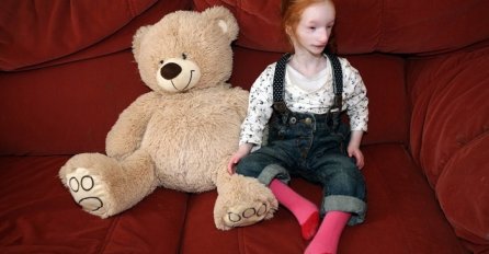 Rođena beba izgledala poput lutke, a 5 godina kasnije ljekari izjavili da nikada nisu vidjeli djevojčicu poput nje (VIDEO)