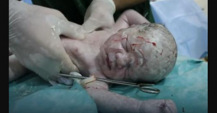 Na putu do bolnice, ova trudnica je pogođena u stomak: Svi su mislili da neće preživjeti ni ona ni beba, ali onda se desilo čudo (VIDEO)
