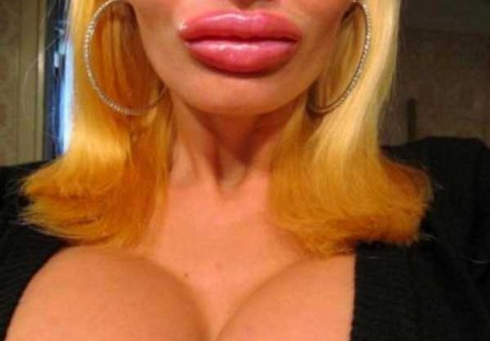 Od prirodne ljepotice do silikonske barbike! Nije odustala dok plastičnim operacijama nije u potpunosti promijenila svoj izgled