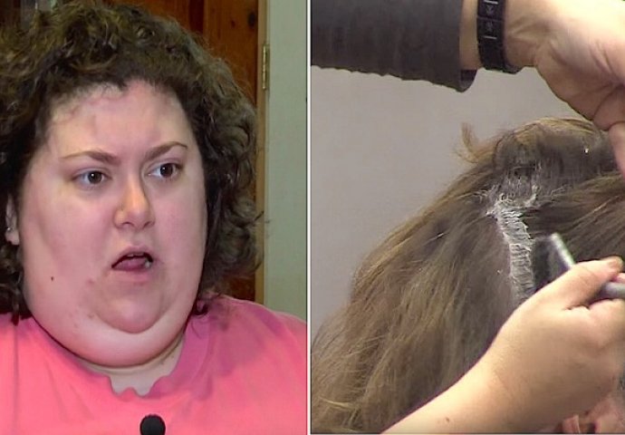  Zbog bolesti doživjela je najveće poniženje u životu: Frizerka joj je pogledala kosu i odbila da je dodirne (VIDEO)