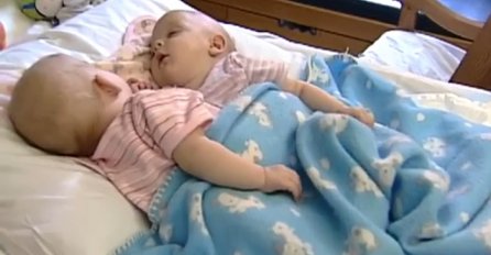 Majka je rodila spojene blizankinje: 10 godina kasnije, izgledaju totalno drugačije (VIDEO)
