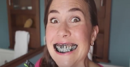 Grozno izgleda, ali će vam za par minuta zubi biti blistavo bijeli (VIDEO)