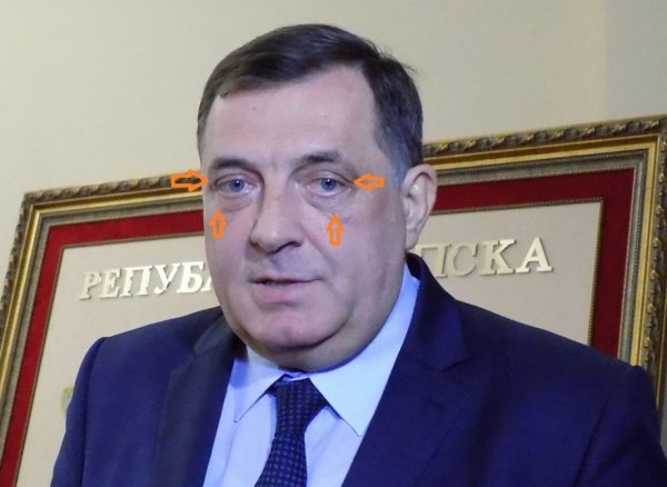 dodik-poslije-operacije-istinito-com