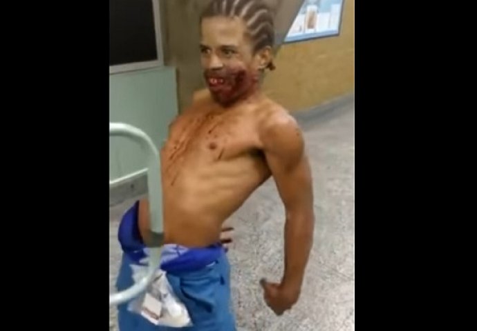 ZASTRAŠUJUĆI VIDEO: Čovjek s jezivim ozljedama tumara bolničkim hodnikom, izgleda kao opsjednut vragom