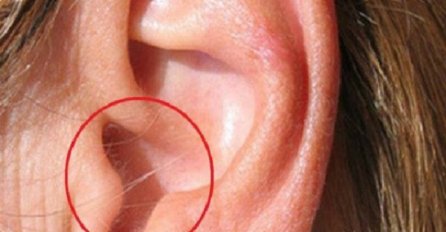 Velike dlake u ušima su prvi znakove ove bolesti