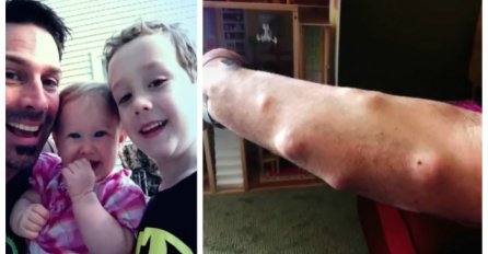 Stalno je nosio duge rukave zbog strašnih izraslina! Kada je otišao doktoru, šokirao se šta su mu rekli (VIDEO)