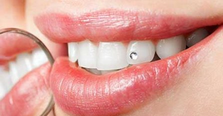 Istaknite lijep osmijeh i zablistajte uz zubni cirkon u Stomatološkoj ordinaciji 3D!