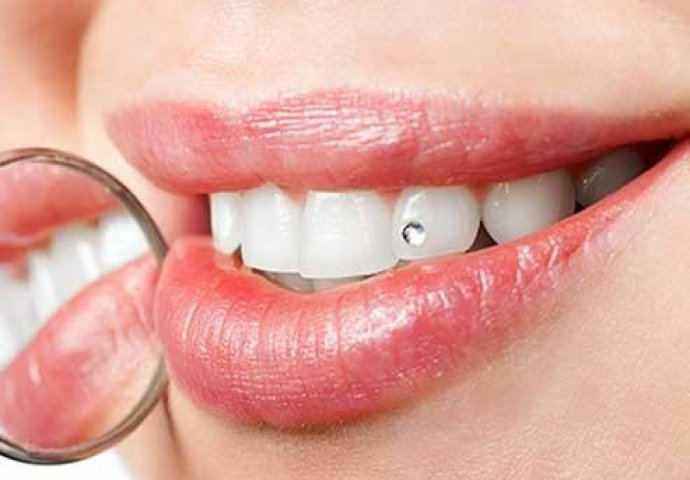 Istaknite lijep osmijeh i zablistajte uz zubni cirkon u Stomatološkoj ordinaciji 3D!
