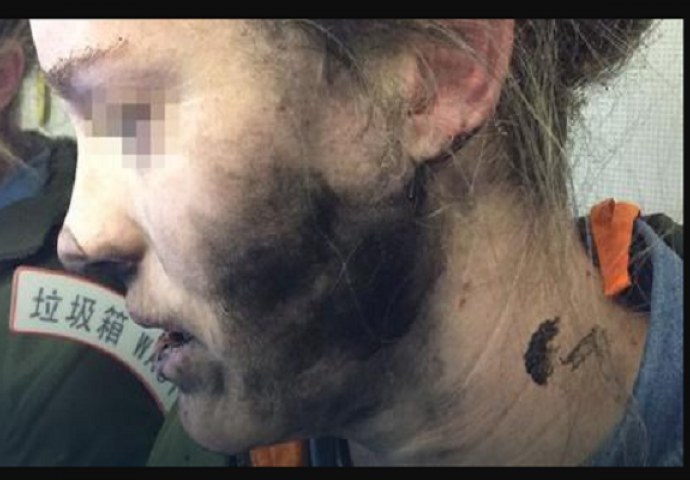 Drama u avionu: Putnici eksplodirale slušalice u ušima dok je spavala (FOTO)