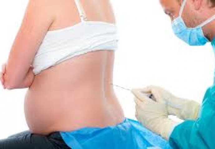 Trudnoća i POROD: 7 činjenica o epiduralnoj analgeziji
