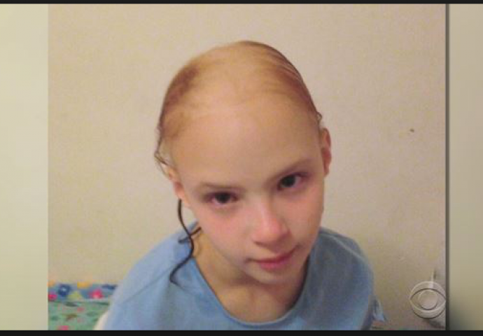 Zamislite da imate deset godina i izgubite svu kosu od proizvoda za kojeg su tvrdili da je siguran! To se dogodilo upravo ovoj djevojčici (VIDEO)