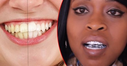 REZULTATI VIDLJIVI ISTOG TRENA: Izbijelite zube pomoću ALU FOLIJE! (VIDEO)