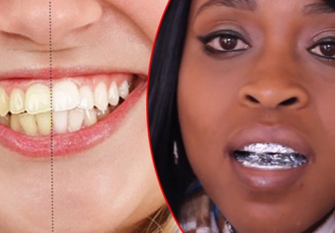 REZULTATI VIDLJIVI ISTOG TRENA: Izbijelite zube pomoću ALU FOLIJE! (VIDEO)