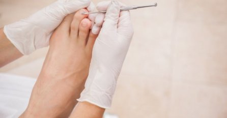 SADA TO MOŽETE I SAMI: Riješite se uraslog nokta u 7 KORAKA!