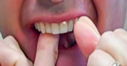 Cijelo vrijeme radimo pogrešno: Ovom tehnikom ćete imati uvijek kristalno čiste i zdrave zube (VIDEO)