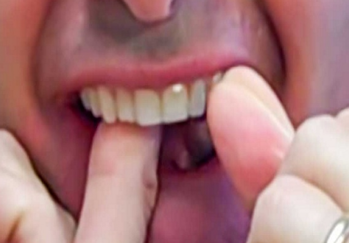 Cijelo vrijeme radimo pogrešno: Ovom tehnikom ćete imati uvijek kristalno čiste i zdrave zube (VIDEO)