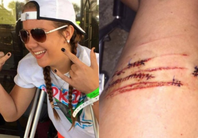 STRAVIČNO  Djevojka otkrila kako je preživjela napad morskog psa: "Vidjela sam kako mi se približava i odjednom me zgrabio"
