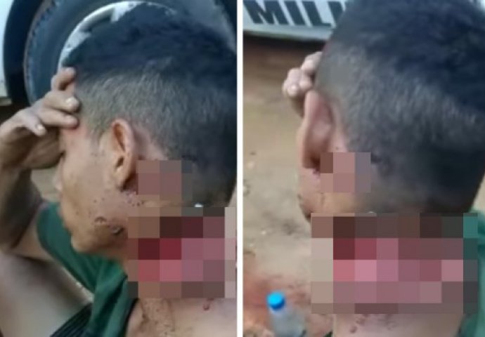 PLJAČKAŠI NAPALI MLADIĆA I BRUTALNO GA ISJEKLI PO VRATU: Držao rukom glavu da ne otpadne (UZNEMIRUJUĆI VIDEO)