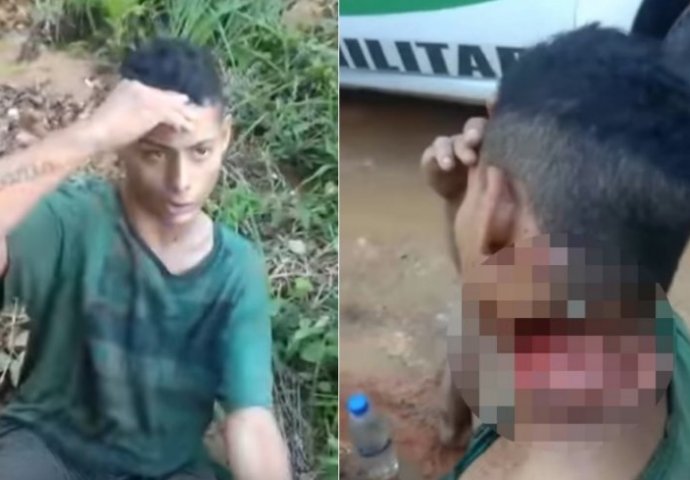 Lopovi napali mladića i brutalno ga isjekli po vratu (UZNEMIRUJUĆI VIDEO)