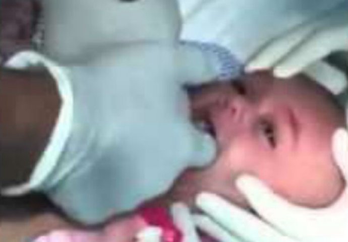 ODVELI SU BEBU U HITNU JER NIJE MOGLA DISATI: Kada su vidjeli šta su doktori izvukli iz njenog grla ZANIJEMILI SU! (VIDEO)