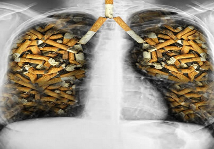 Namjeravate se riješiti opasne navike pušenja? Ove namirnice će vam pomoći da se držite dalje od cigareta