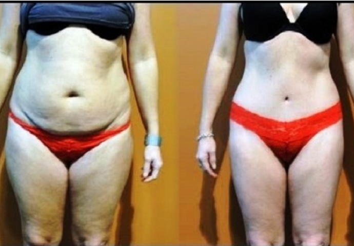 Za pola mjeseca i do 15 kg manje: Popularna dijeta ne samo da skida kilograme već i čisti kožu i poboljšava prbavu