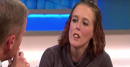 Svi su je ismijavali zbog njenih krivih zuba, no čekajte da vidite kako izgleda danas (VIDEO)