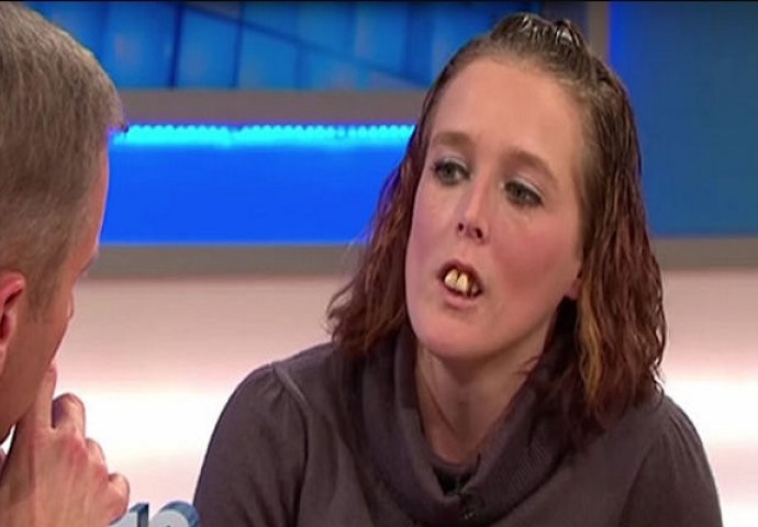 Svi su je ismijavali zbog njenih krivih zuba, no čekajte da vidite kako izgleda danas (VIDEO)