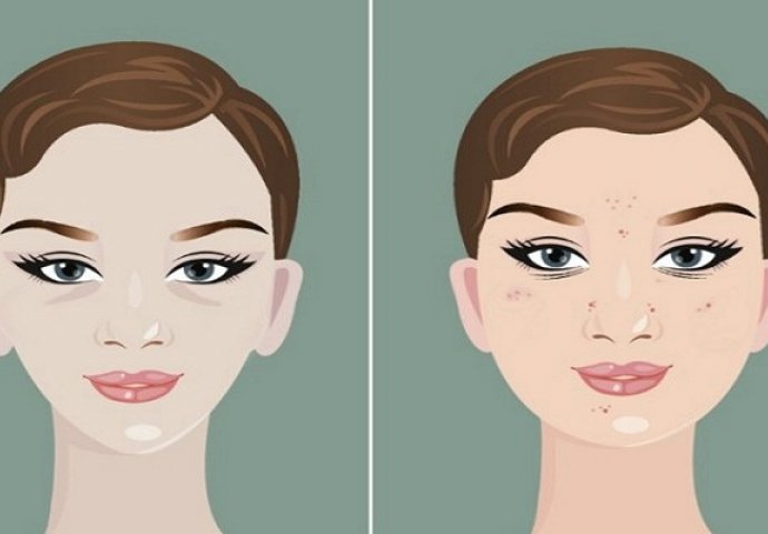 3 tipa lica: Male promjene koje otkrivaju što se događa s vašim tijelom