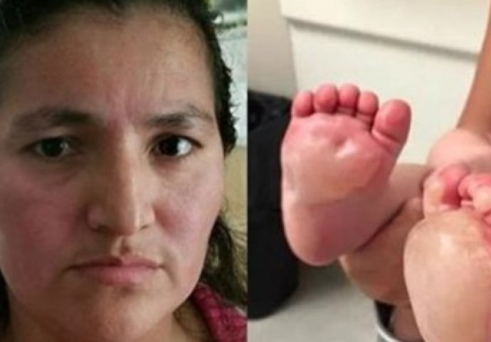 MONSTRUOZNO: Majka je otkrila čudne plikove na bebinim stopalima, a onda je otkrila ZASTRAŠUJUĆU ISTINU! (VIDEO)