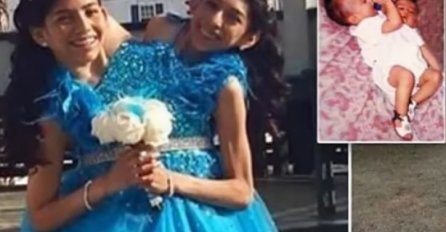 UPRKOS TEŠKOM ZDRAVSTVENOM STANJU: Sijamske bliznakinje (16) neće na operaciju, a razlog će vas ostaviti u suzama! (VIDEO)