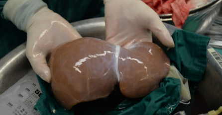 Ljudi zarađuju na svojim organima: Evo kako se kreću cijene ljudskih organa na crnom tržištu