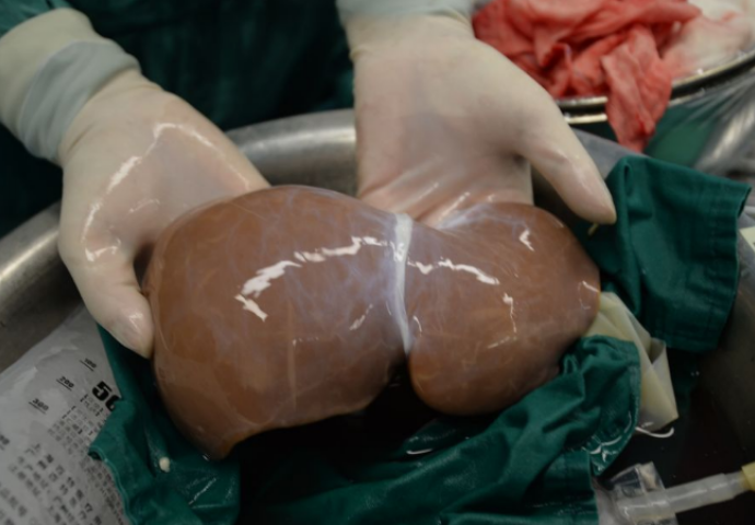 Ljudi zarađuju na svojim organima: Evo kako se kreću cijene ljudskih organa na crnom tržištu