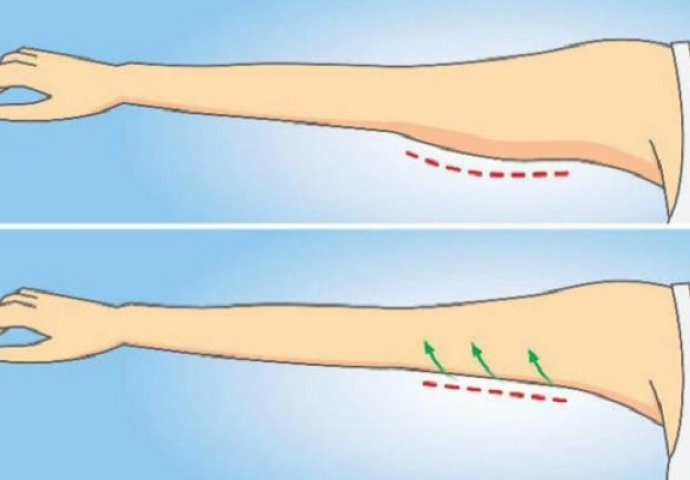 8 iznenađujućih načina kako da se otarasite mlitavih ruku bez teretane i mukotrpnog trčanja