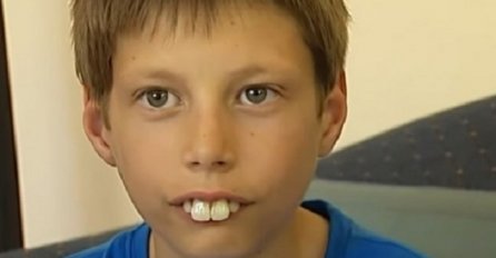 Maltretirali su ga u školi, zvali su ga DJEČAK ZEC, poslije pet godina sve se preokrenulo, on se totalno promijenio! (VIDEO)