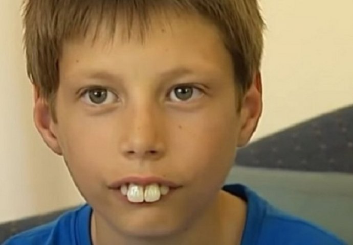 Maltretirali su ga u školi, zvali su ga DJEČAK ZEC, poslije pet godina sve se preokrenulo, on se totalno promijenio! (VIDEO)