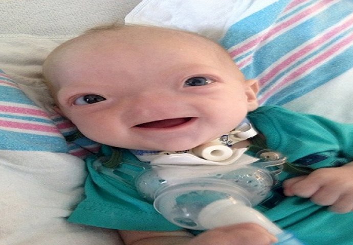 Ova nesrećna beba je zbog rijetkog genetskog poremećaja rođena bez nosa: Evo kako ona danas izgleda poslije više desetina operacija