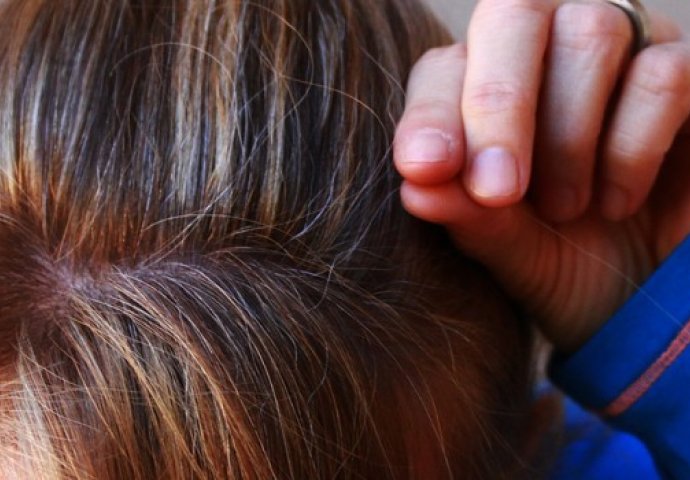 Sijeda kosa nije samo znak starosti, već u pitanju može da bude ova OPASNA bolest!
