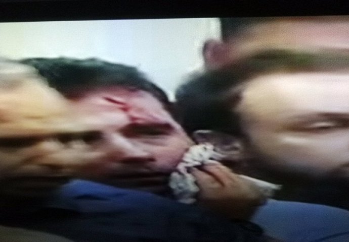 Krvave glave na sve strane: Opšti haos u Makedoniji, batine dobio i Zoran Zaev (UZNEMIRUJUĆI FOTO)