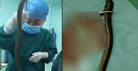 Ljekari mu iz zadnjice izvadili jegulju dugu pola metra, razlog zbog kojeg je ugurao u tijelo je bizaran (VIDEO)