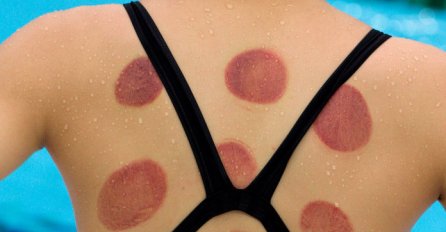 Kada vidite rezultate ove METODE LIJEČENJA, nikada nećete otići kod doktora ALTERNATIVNE MEDICINE! (FOTO)