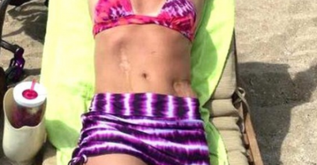 Ona se smije za kameru, ali kada ljudi pogledaju cijelu fotografiju saznaju za bolnu istinu o njenom tijelu!